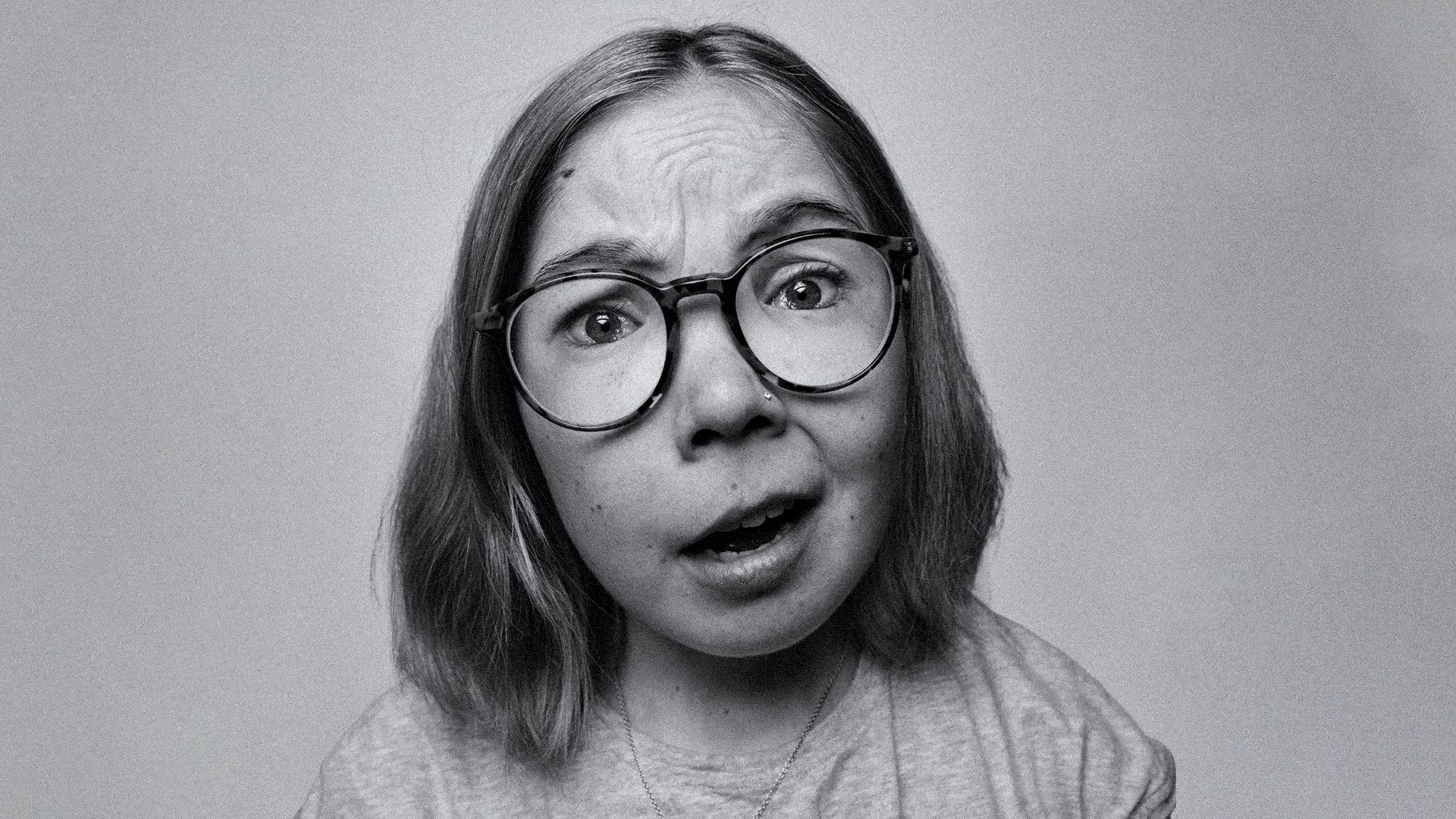 Black and white portrait of a young adult woman with shoulder length hair, round glasses and facial swelling, speaking directly to the camera.
